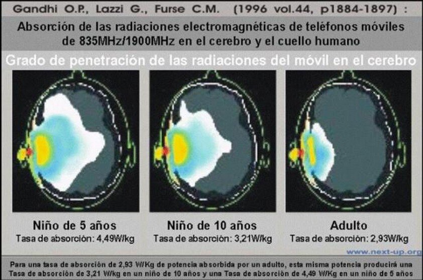 1996-efectos de la radiación no ionizante por telefonia movil en la cabeza